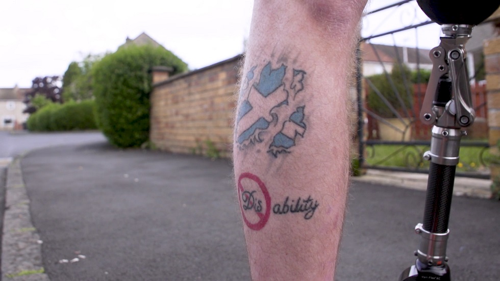 Martin Perry and his disability tattoo